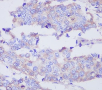MMP2 Rabbit Monoclonal Antibody