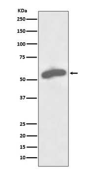 G6PD/Glucose 6 Phosphate Dehydrogenase Rabbit Monoclonal Antibody