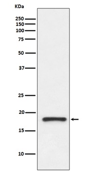 Prealbumin TTR Rabbit Monoclonal Antibody