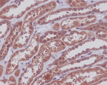 Anti-MEK1/2 MAP2K1 Rabbit Monoclonal Antibody