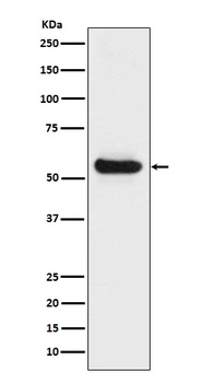 Lipoprotein lipase LPL Rabbit Monoclonal Antibody
