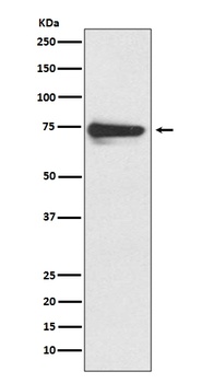 Tyrosinase Rabbit Monoclonal Antibody
