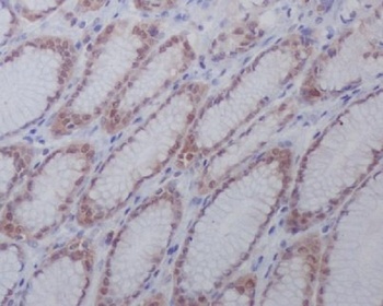 Anti-active + pro Caspase 3 CASP3 Rabbit Monoclonal Antibody