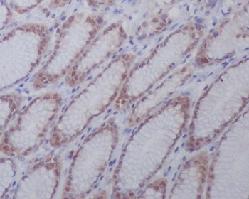 active + pro Caspase 3 CASP3 Rabbit Monoclonal Antibody