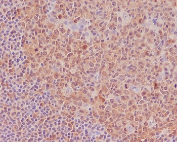 Anti-Caspase-3 CASP3 Rabbit Monoclonal Antibody
