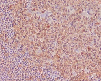 Caspase-3 CASP3 Rabbit Monoclonal Antibody