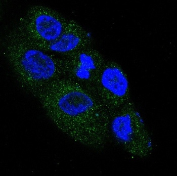 NGF/Beta Ngf Rabbit Monoclonal Antibody
