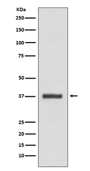 CDK6 Rabbit Monoclonal Antibody