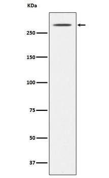 Thyroglobulin TG Rabbit Monoclonal Antibody