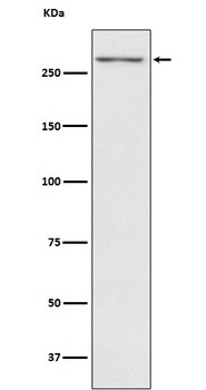 Thyroglobulin TG Rabbit Monoclonal Antibody