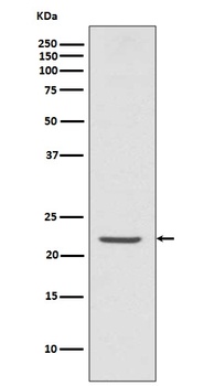TMS1 PYCARD Rabbit Monoclonal Antibody