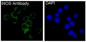 iNOS NOS2 Rabbit Monoclonal Antibody