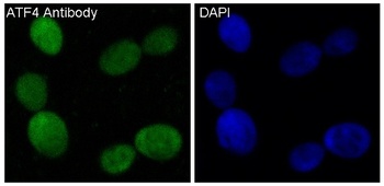 ATF4 Rabbit Monoclonal Antibody