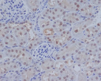 ATF4 Rabbit Monoclonal Antibody