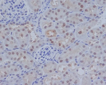 Anti-ATF4 Rabbit Monoclonal Antibody