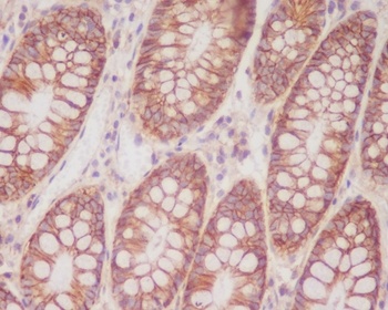 Anti-CD46 Rabbit Monoclonal Antibody