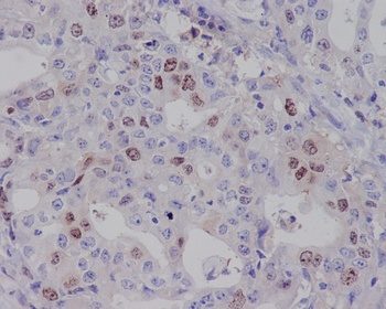 Survivin BIRC5 Rabbit Monoclonal Antibody