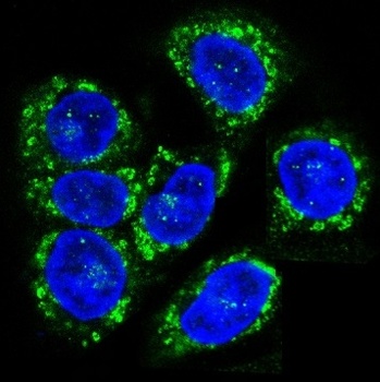 CCR7 Rabbit Monoclonal Antibody