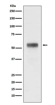 Retinoic Acid Receptor alpha RARA Rabbit Monoclonal Antibody