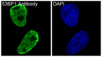 Anti-53BP1 TP53BP1 Rabbit Monoclonal Antibody