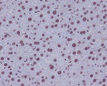 Anti-53BP1 TP53BP1 Rabbit Monoclonal Antibody