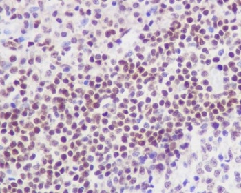 Anti-FLI1 Rabbit Monoclonal Antibody