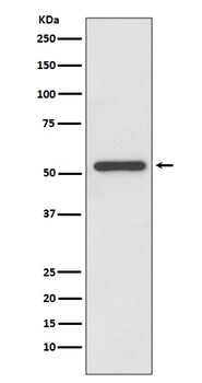 MMP13 Rabbit Monoclonal Antibody