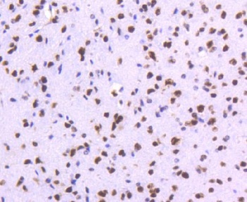 Anti-TOP1/Topoisomerase I Rabbit Monoclonal Antibody