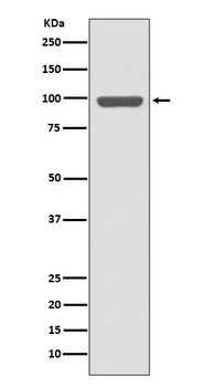 Insulin Receptor INSR Rabbit Monoclonal Antibody