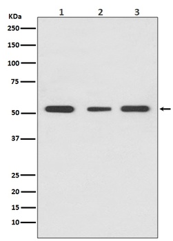 PPAR gamma Rabbit Monoclonal Antibody
