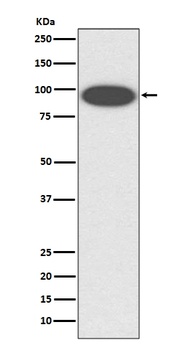 CD18 ITGB2 Rabbit Monoclonal Antibody