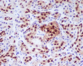 Anti-PDX1/Ipf1 Rabbit Monoclonal Antibody