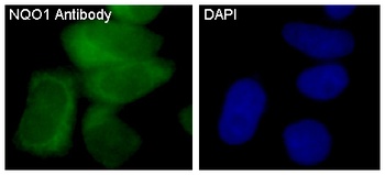 NQO1/Dt Diaphorase Rabbit Monoclonal Antibody