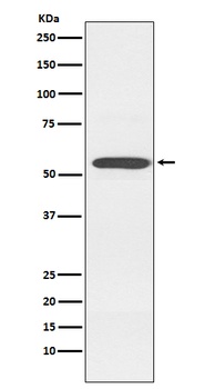 Cytochrome P450 2D6 CYP2D6 Monoclonal Antibody