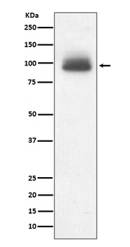 GR NR3C1 Rabbit Monoclonal Antibody