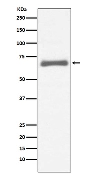 AFP/Alpha 1 Fetoprotein Rabbit Monoclonal Antibody