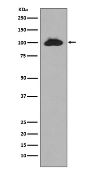 STAT6 Rabbit Monoclonal Antibody