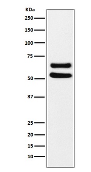 Ikaros Monoclonal Antibody