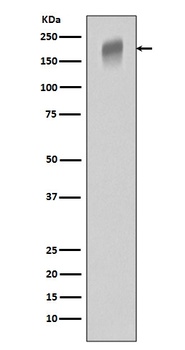 VEGF Receptor 1 FLT1 Rabbit Monoclonal Antibody