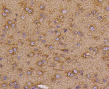 Anti-VEGF Receptor 1 FLT1 Rabbit Monoclonal Antibody