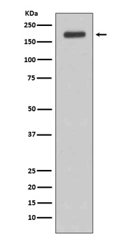 ErbB Rabbit Monoclonal Antibody