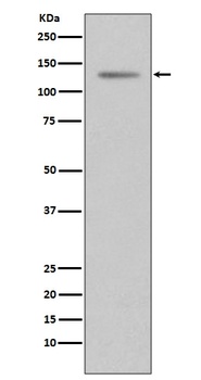 Progesterone Receptor PGR Rabbit Monoclonal Antibody