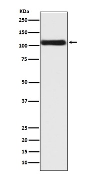 Anti-Androgen Receptor AR Rabbit Monoclonal Antibody
