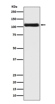 Androgen Receptor AR Rabbit Monoclonal Antibody