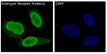 Anti-Androgen Receptor AR Rabbit Monoclonal Antibody