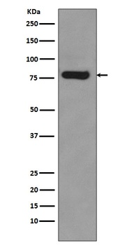 Androgen Receptor (AR-V7 specific) Rabbit Monoclonal Antibody