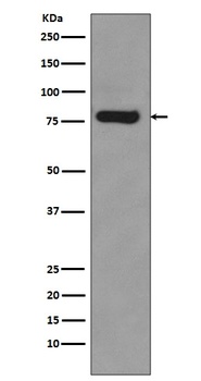 Anti-Androgen Receptor (AR-V7 specific) Rabbit Monoclonal Antibody