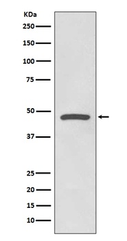 Cyclin E1 CCNE1 Rabbit Monoclonal Antibody