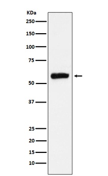 ALDH2 Rabbit Monoclonal Antibody