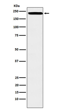 ZEB1 Rabbit Monoclonal Antibody